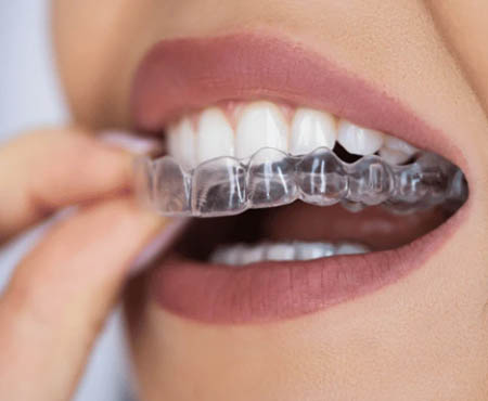 franklin street dentistry simply clear image