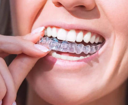 franklin street dentistry simply clear image